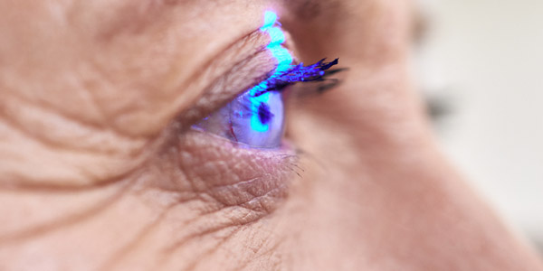 Eyecare Services at Snead Eye Group | YAG Laser Treatment