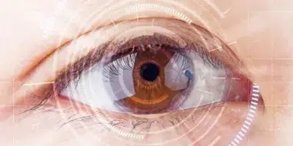 Vivity-Lenses-IOL for Cataract Lens Replacement Vivity-Lenses-IOL for Cataract Lens Replacement in Fort Myers, Naples, Bonita Springs & Cape Coral